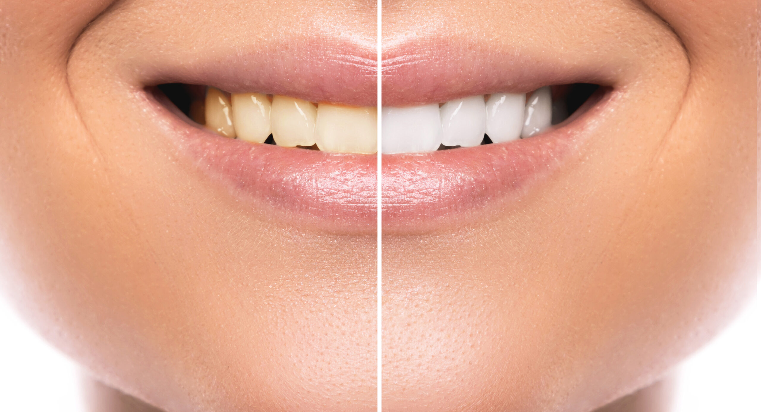 smile gallery